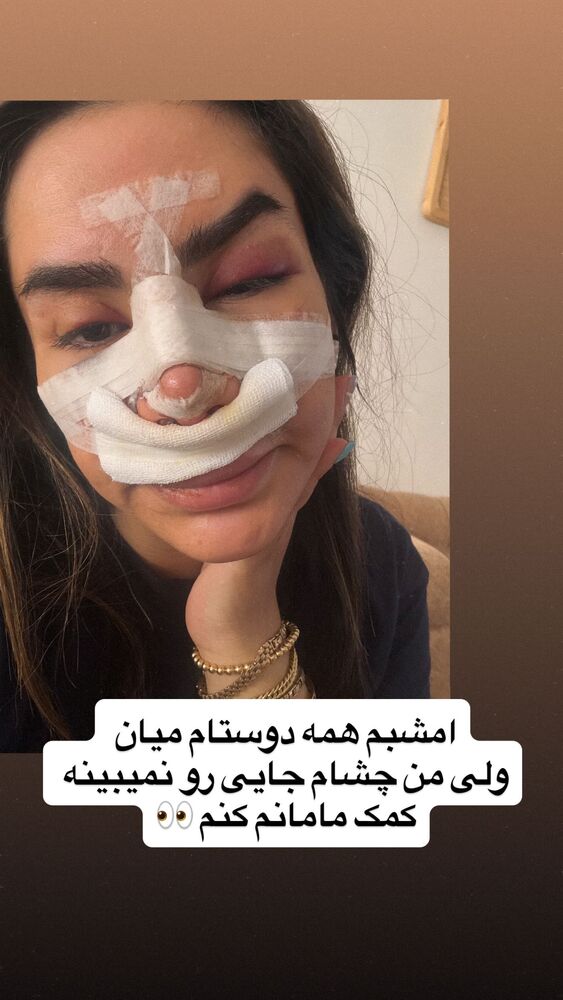  جدید ترین استوری اینستاگرام سپیده دارایی