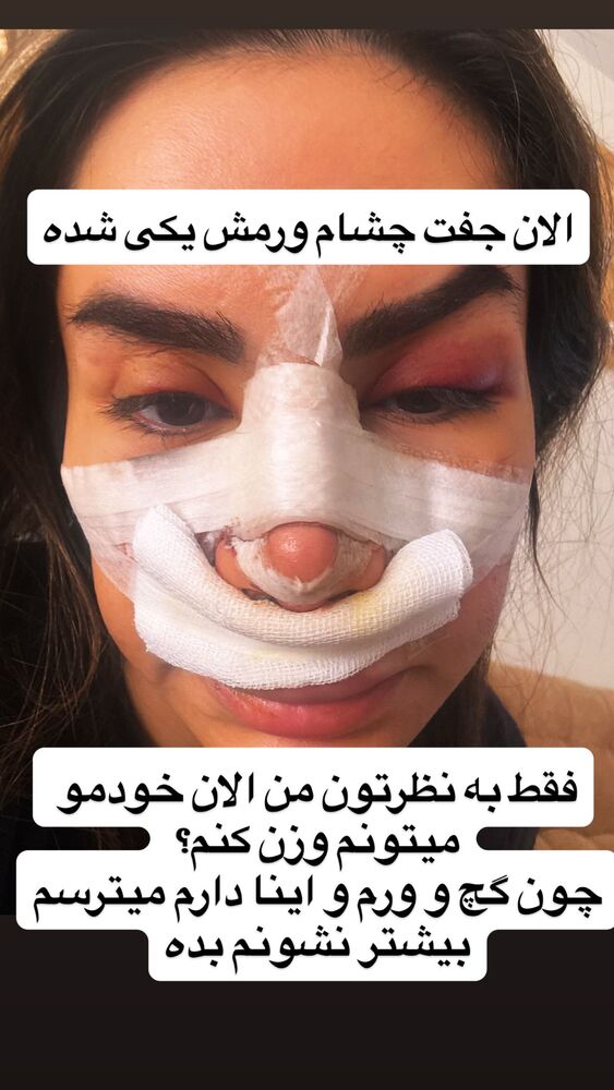  جدید ترین استوری اینستاگرام سپیده دارایی