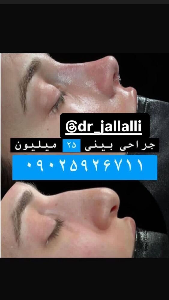  جدید ترین استوری اینستاگرام سپیده دارایی