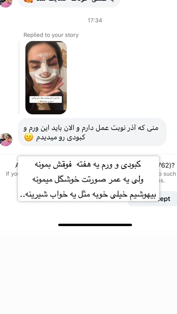  جدید ترین استوری اینستاگرام سپیده دارایی