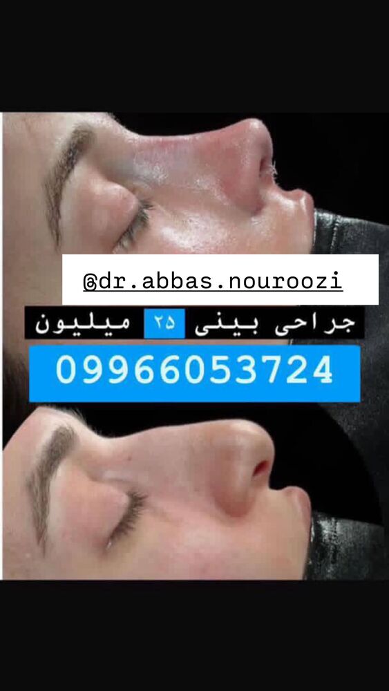  جدید ترین استوری اینستاگرام سپیده دارایی
