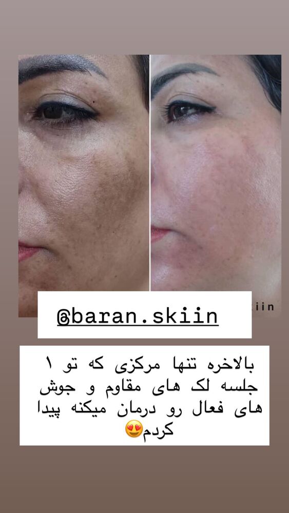  جدید ترین استوری اینستاگرام سپیده دارایی