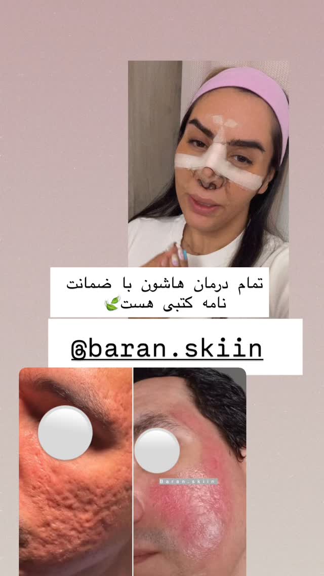  جدید ترین استوری اینستاگرام سپیده دارایی