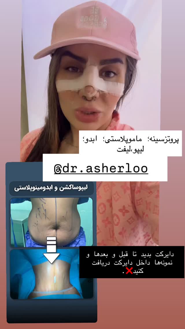  جدید ترین استوری اینستاگرام سپیده دارایی