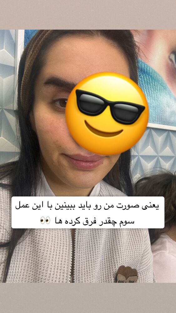  جدید ترین استوری اینستاگرام سپیده دارایی