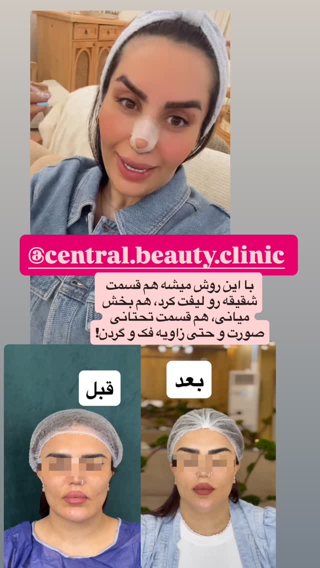  جدید ترین استوری اینستاگرام سپیده دارایی