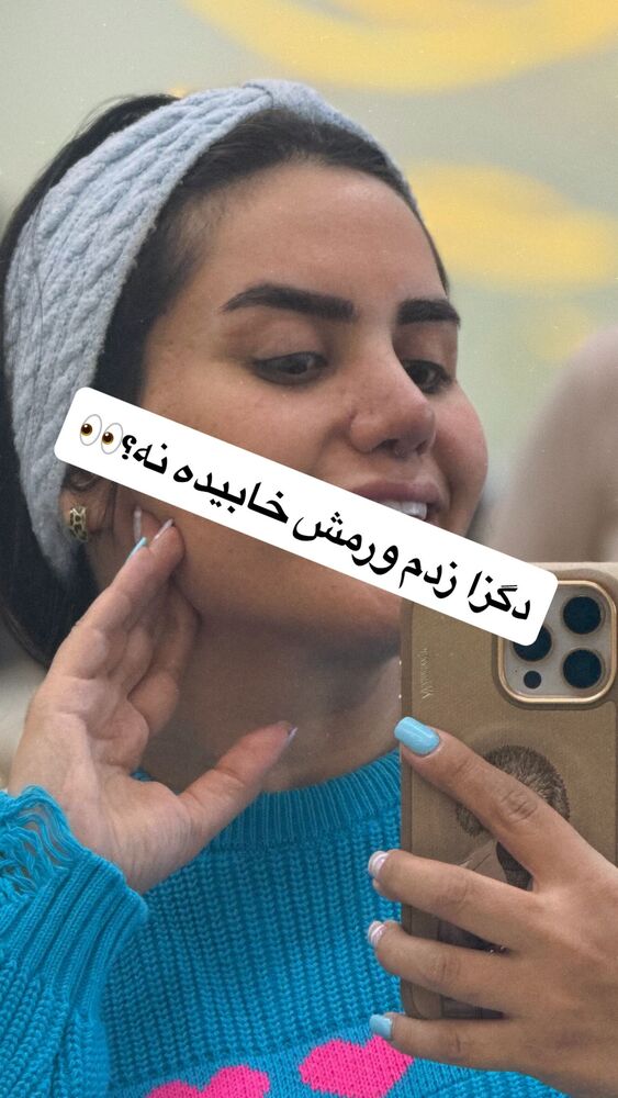  جدید ترین استوری اینستاگرام سپیده دارایی