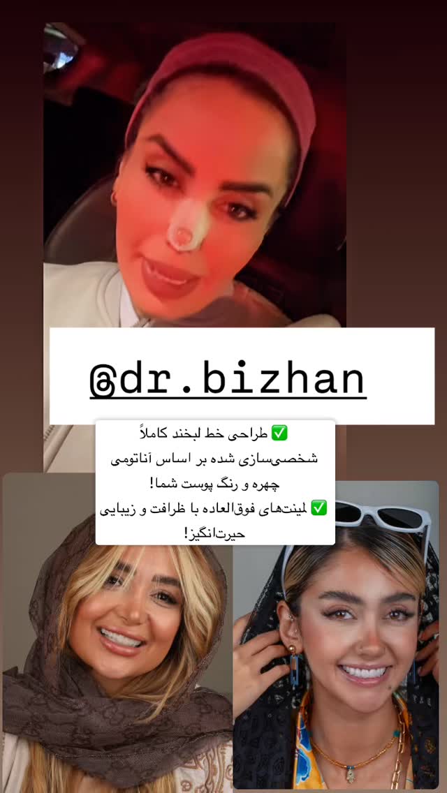  جدید ترین استوری اینستاگرام سپیده دارایی