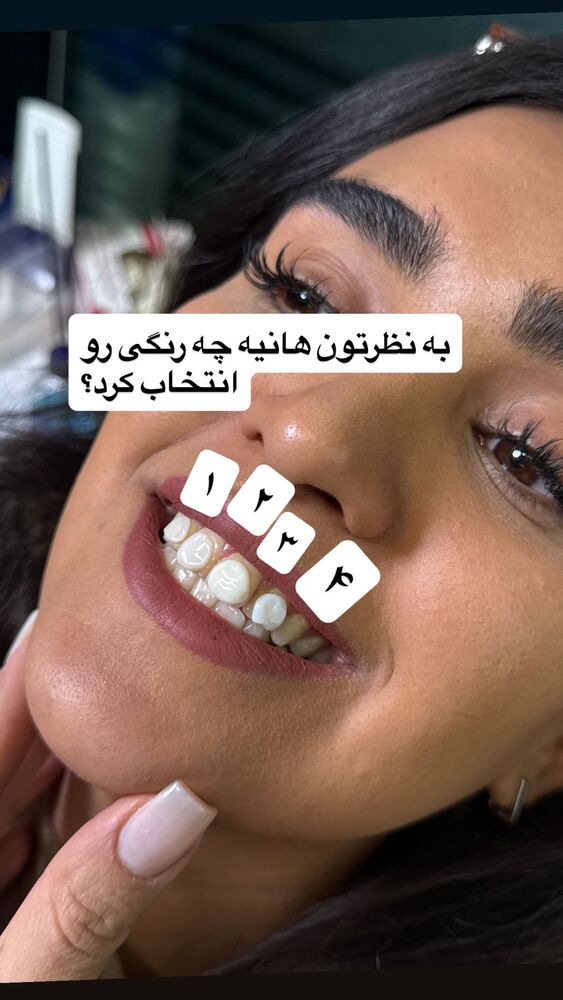  جدید ترین استوری اینستاگرام سپیده دارایی