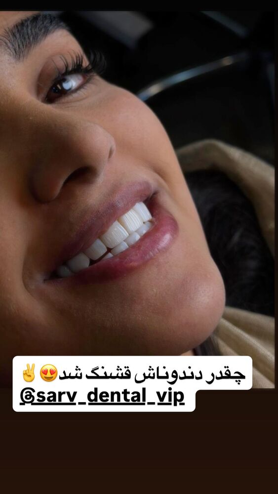  جدید ترین استوری اینستاگرام سپیده دارایی