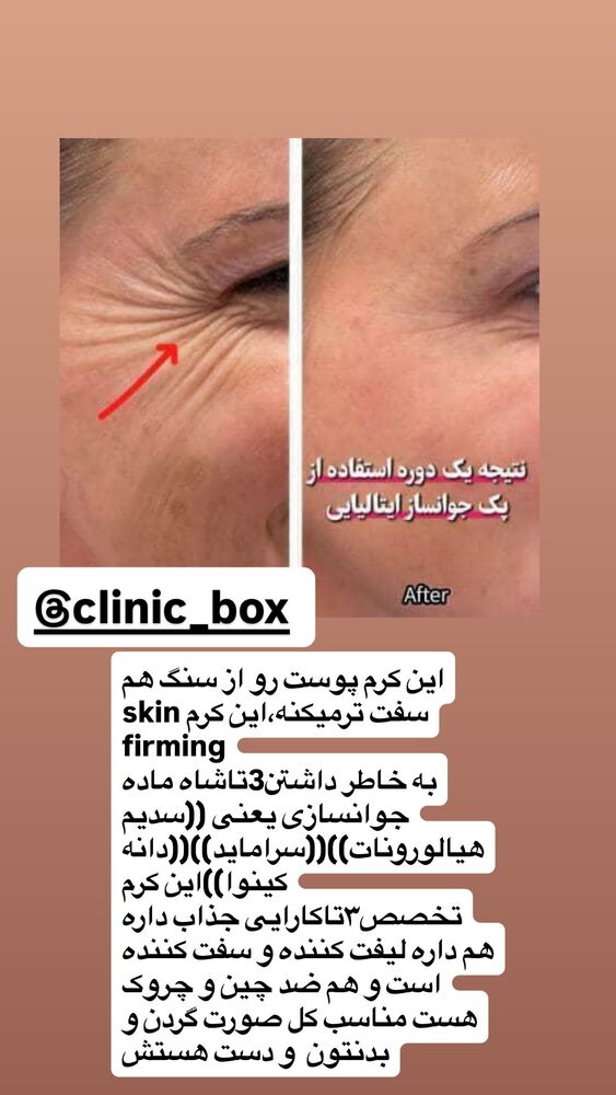  جدید ترین استوری اینستاگرام سپیده دارایی