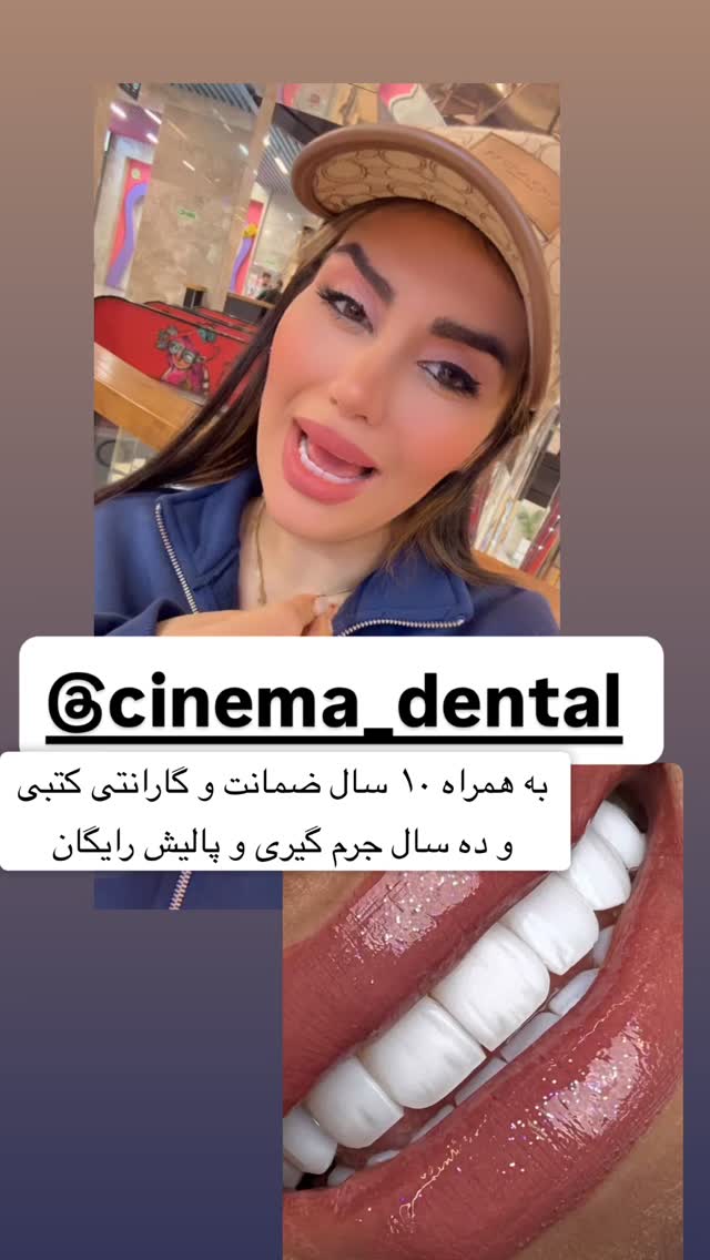  جدید ترین استوری اینستاگرام سپیده دارایی