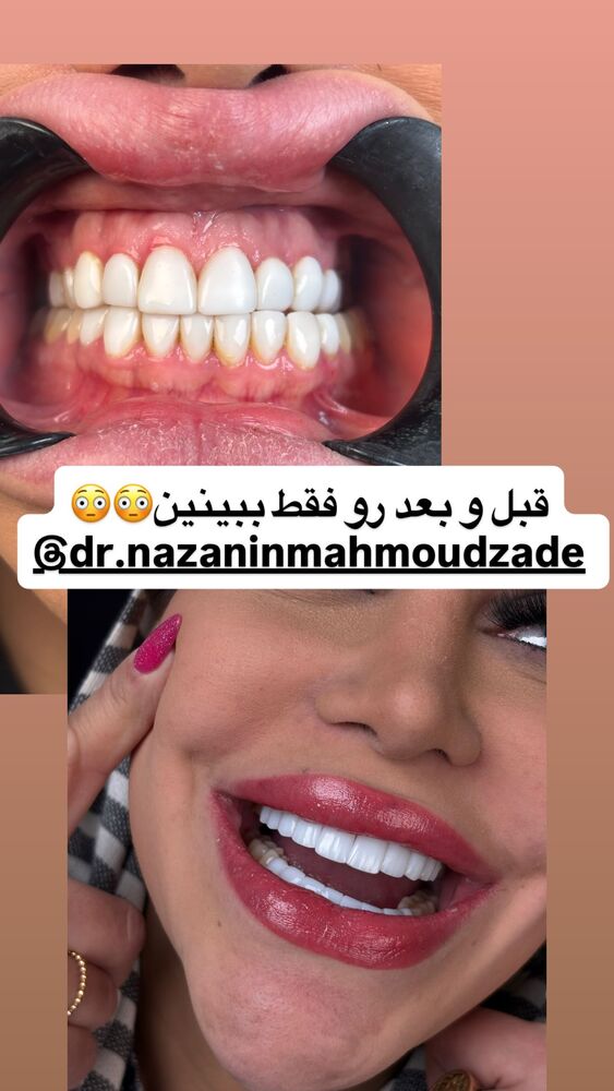  جدید ترین استوری اینستاگرام سپیده دارایی