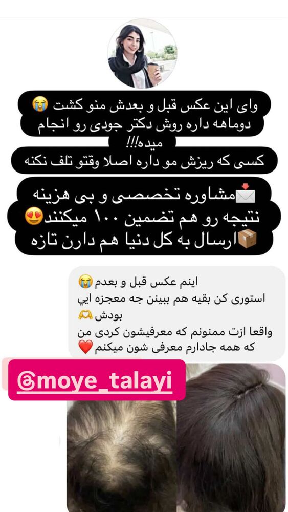  جدید ترین استوری اینستاگرام سپیده دارایی