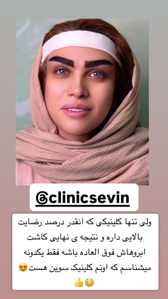  جدید ترین استوری اینستاگرام سپیده دارایی
