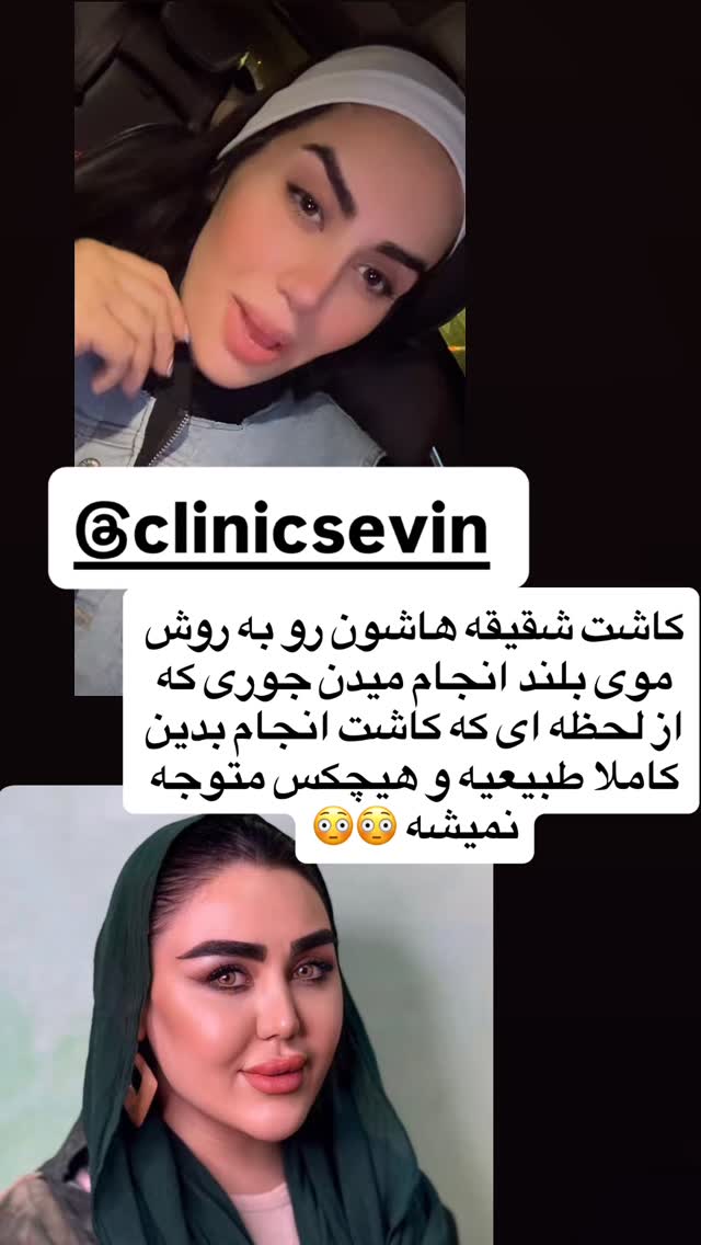  جدید ترین استوری اینستاگرام سپیده دارایی