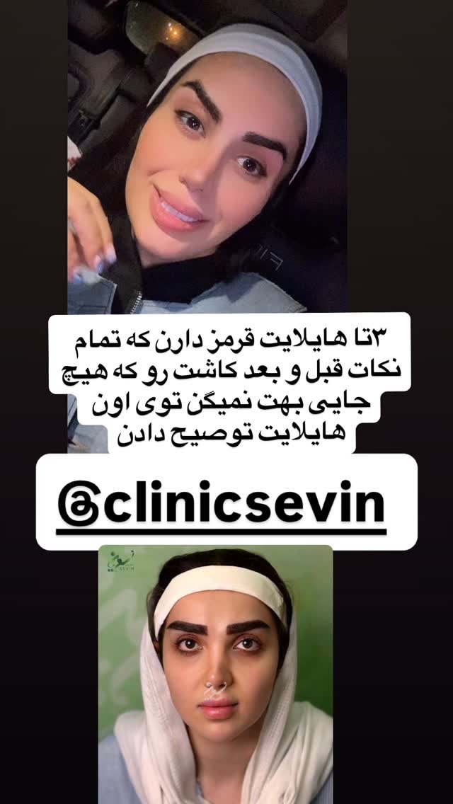  جدید ترین استوری اینستاگرام سپیده دارایی