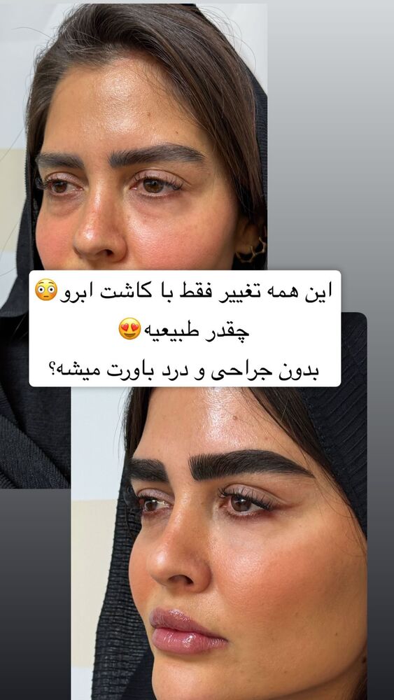  جدید ترین استوری اینستاگرام سپیده دارایی