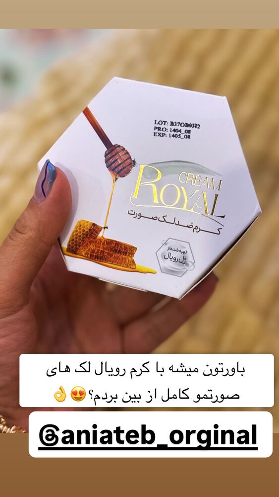  جدید ترین استوری اینستاگرام سپیده دارایی
