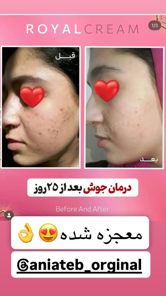 جدید ترین استوری اینستاگرام سپیده دارایی