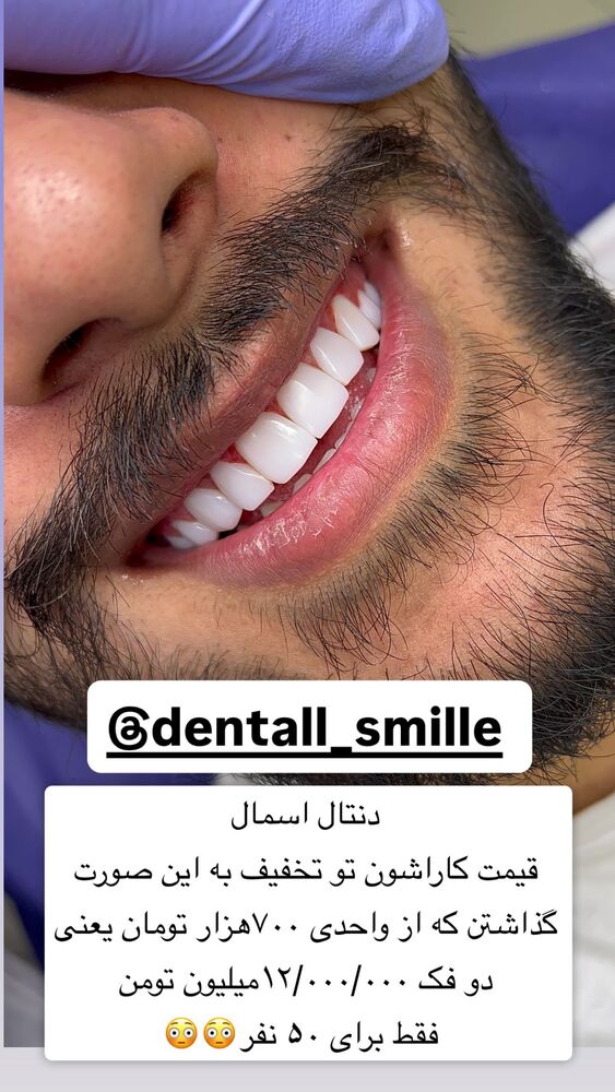  جدید ترین استوری اینستاگرام سپیده دارایی