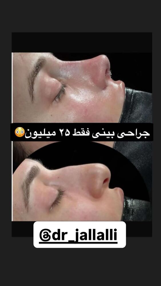  جدید ترین استوری اینستاگرام سپیده دارایی