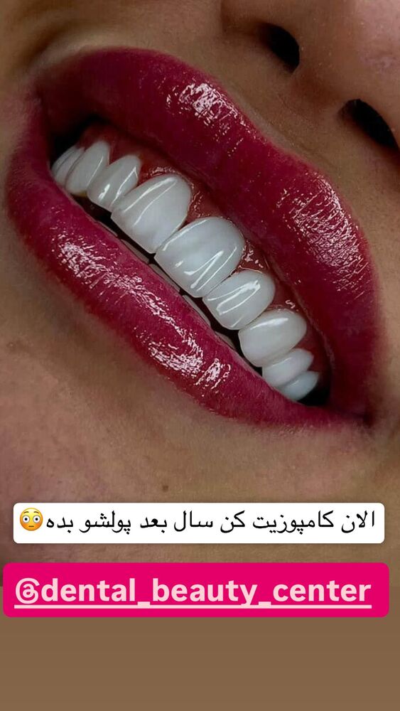  جدید ترین استوری اینستاگرام سپیده دارایی