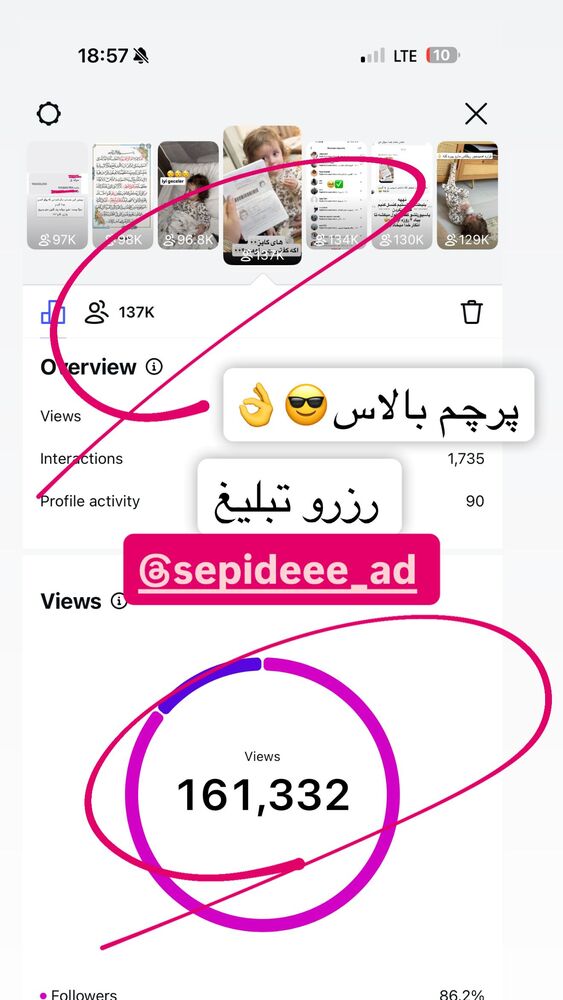  جدید ترین استوری اینستاگرام سپیده دارایی