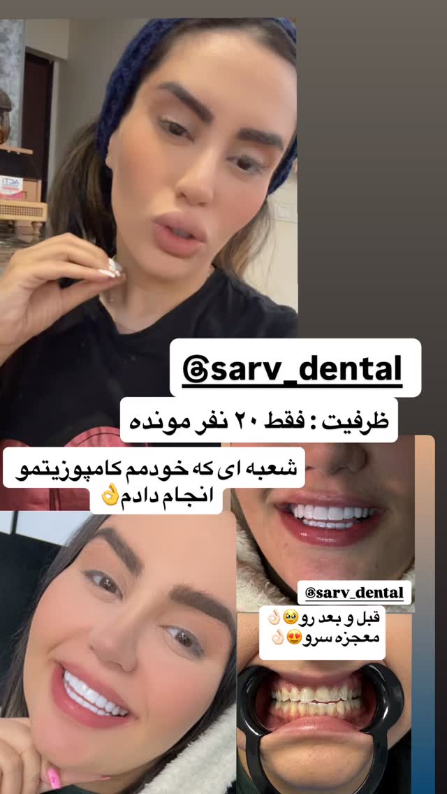  جدید ترین استوری اینستاگرام سپیده دارایی