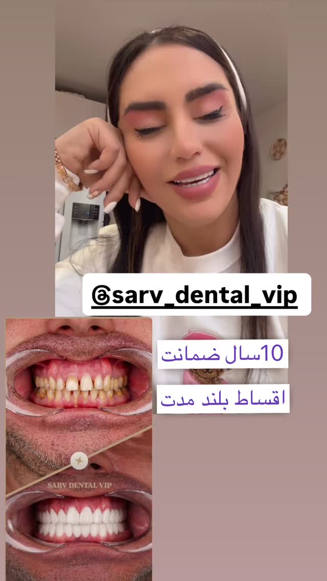  جدید ترین استوری اینستاگرام سپیده دارایی