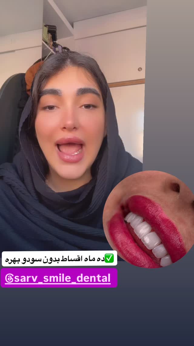  جدید ترین استوری اینستاگرام مژده حاتمی