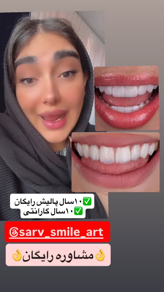  جدید ترین استوری اینستاگرام مژده حاتمی