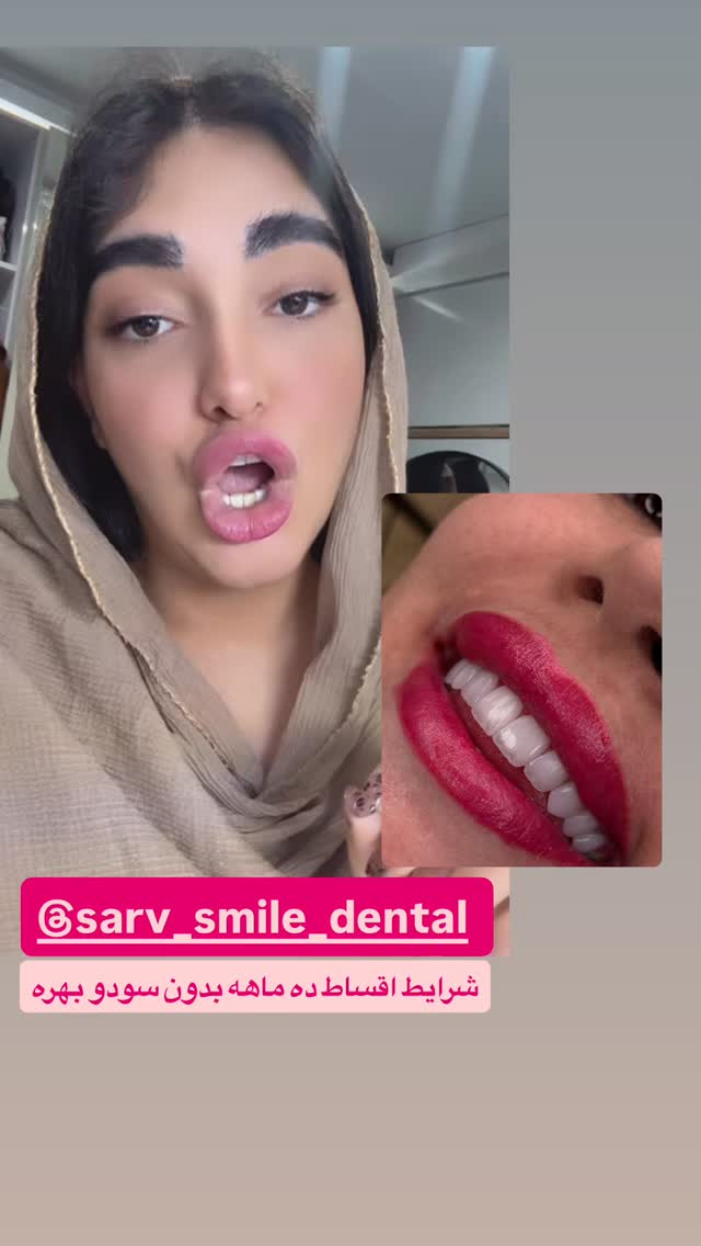  جدید ترین استوری اینستاگرام مژده حاتمی