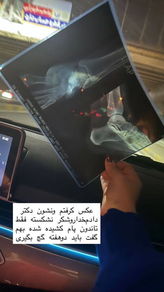  جدید ترین استوری اینستاگرام مژده حاتمی