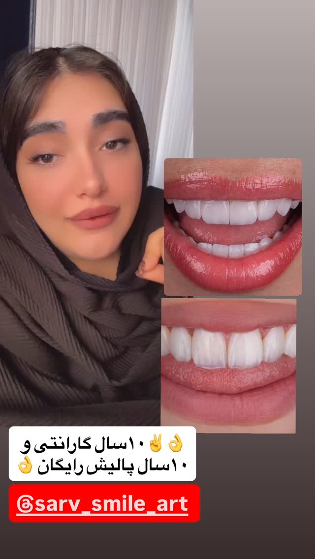  جدید ترین استوری اینستاگرام مژده حاتمی