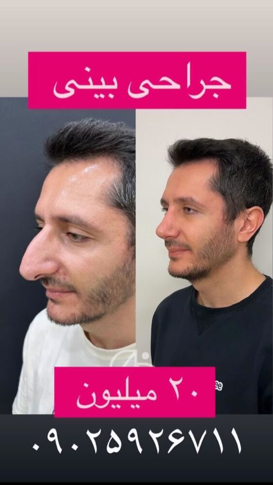  جدید ترین استوری اینستاگرام مژده حاتمی
