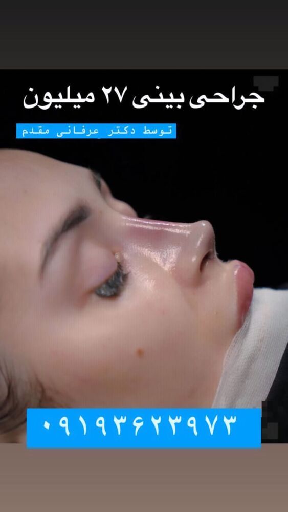  جدید ترین استوری اینستاگرام مژده حاتمی