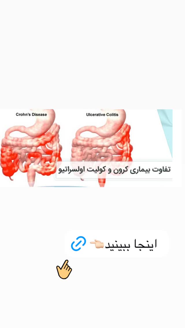  جدید ترین استوری اینستاگرام کیوان میرهادی