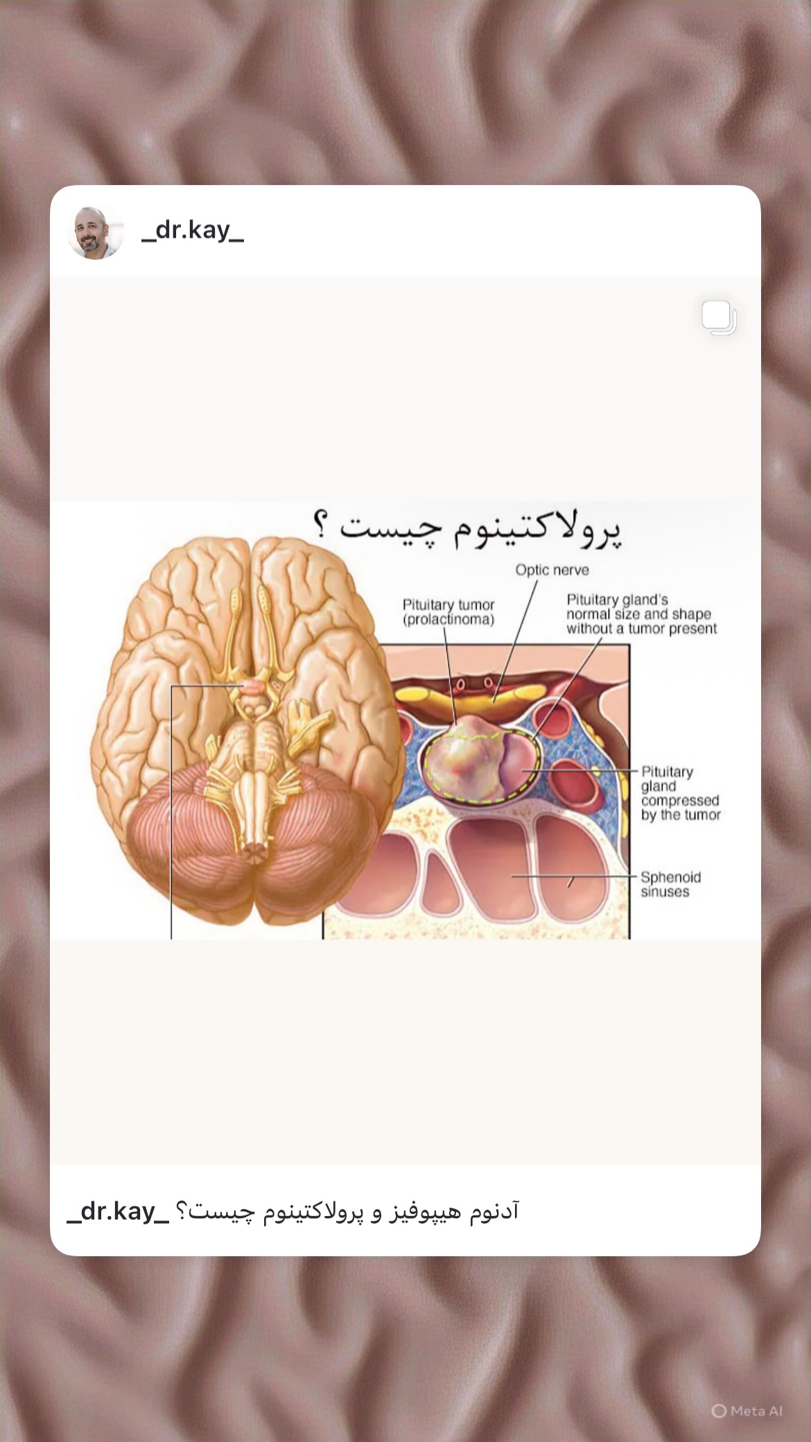  جدید ترین استوری اینستاگرام کیوان میرهادی