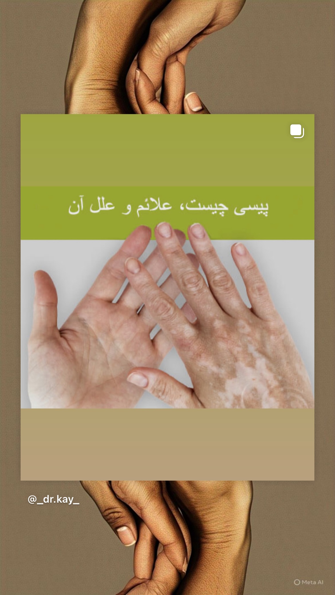  جدید ترین استوری اینستاگرام کیوان میرهادی