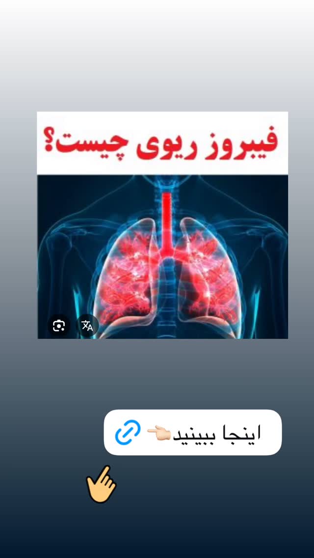 جدید ترین استوری اینستاگرام کیوان میرهادی
