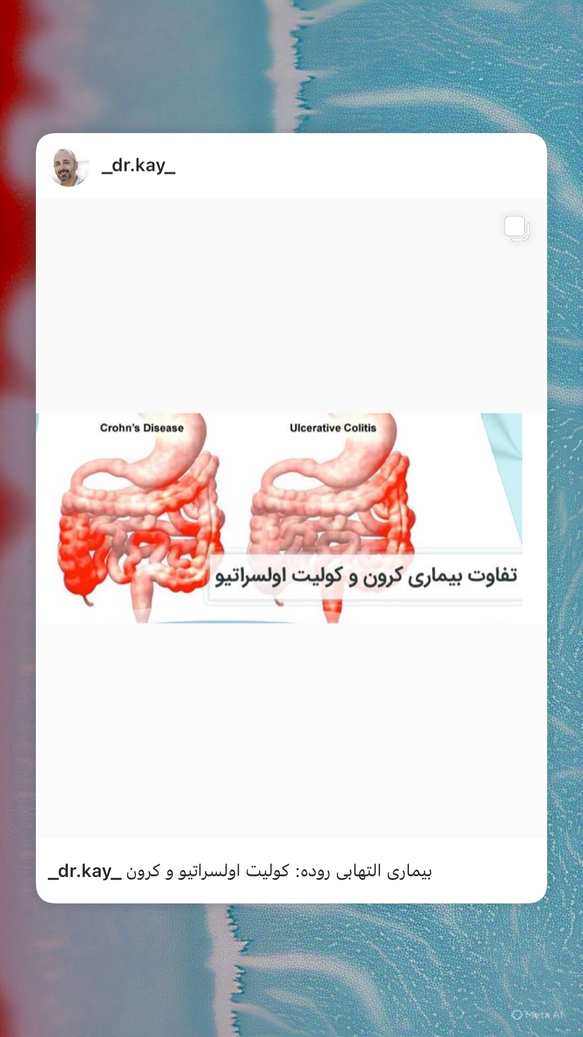  جدید ترین استوری اینستاگرام کیوان میرهادی