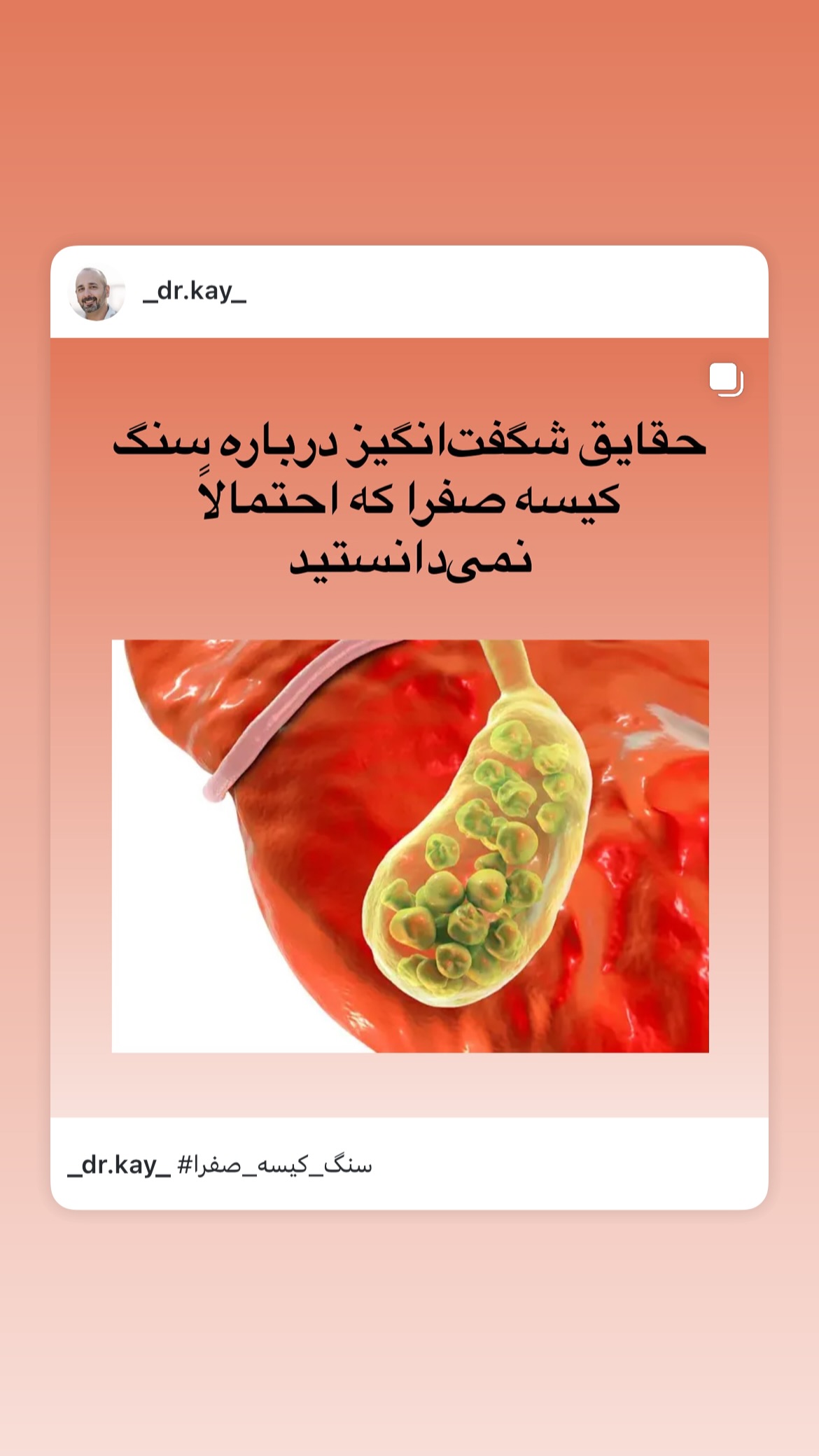  جدید ترین استوری اینستاگرام کیوان میرهادی