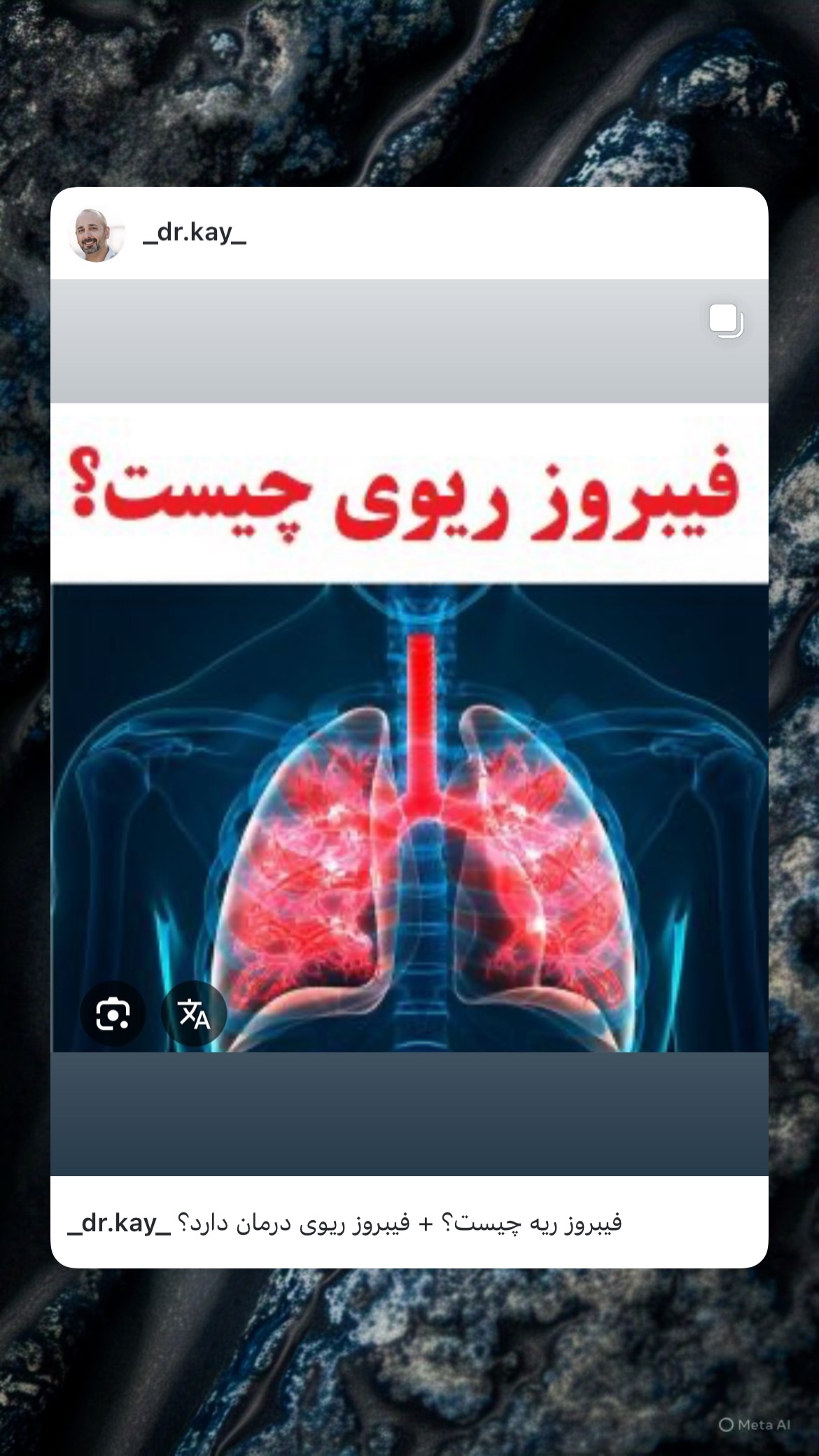  جدید ترین استوری اینستاگرام کیوان میرهادی