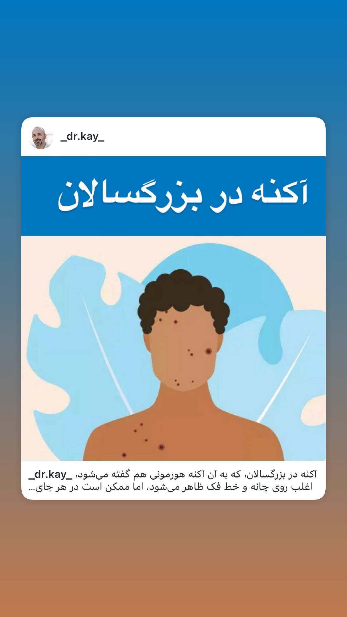  جدید ترین استوری اینستاگرام کیوان میرهادی