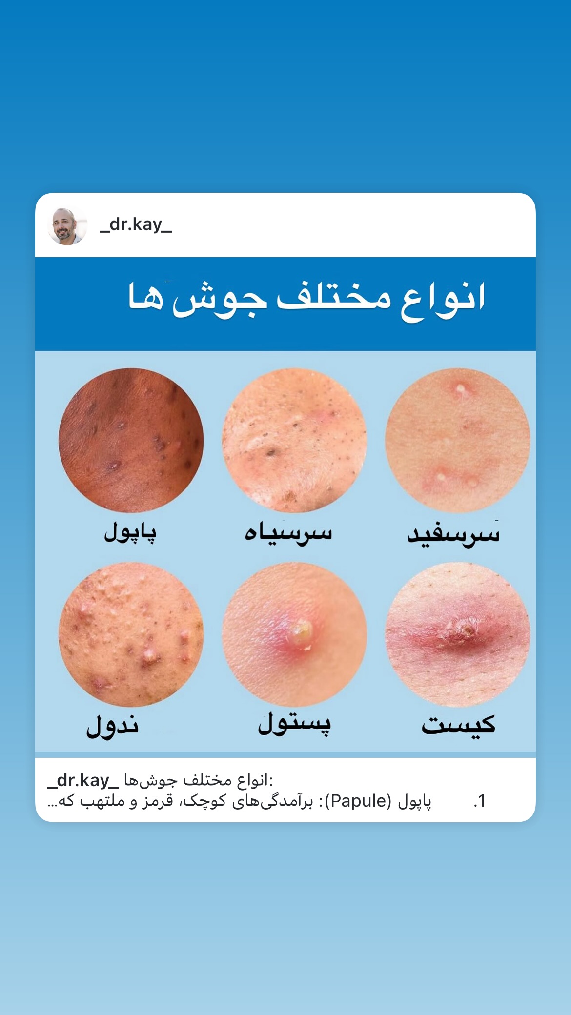  جدید ترین استوری اینستاگرام کیوان میرهادی