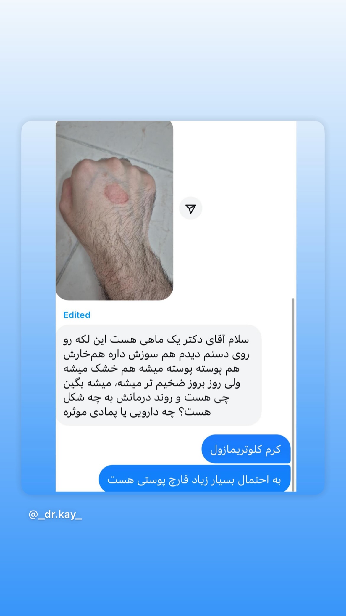  جدید ترین استوری اینستاگرام کیوان میرهادی