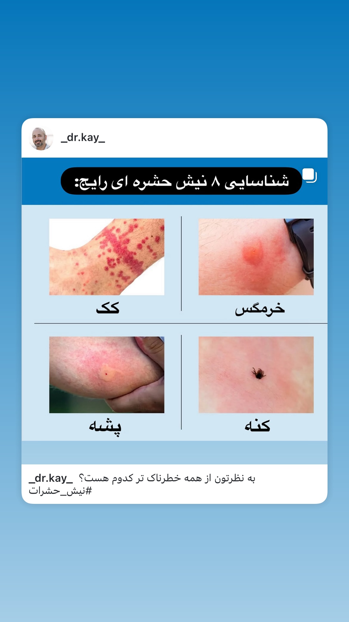  جدید ترین استوری اینستاگرام کیوان میرهادی