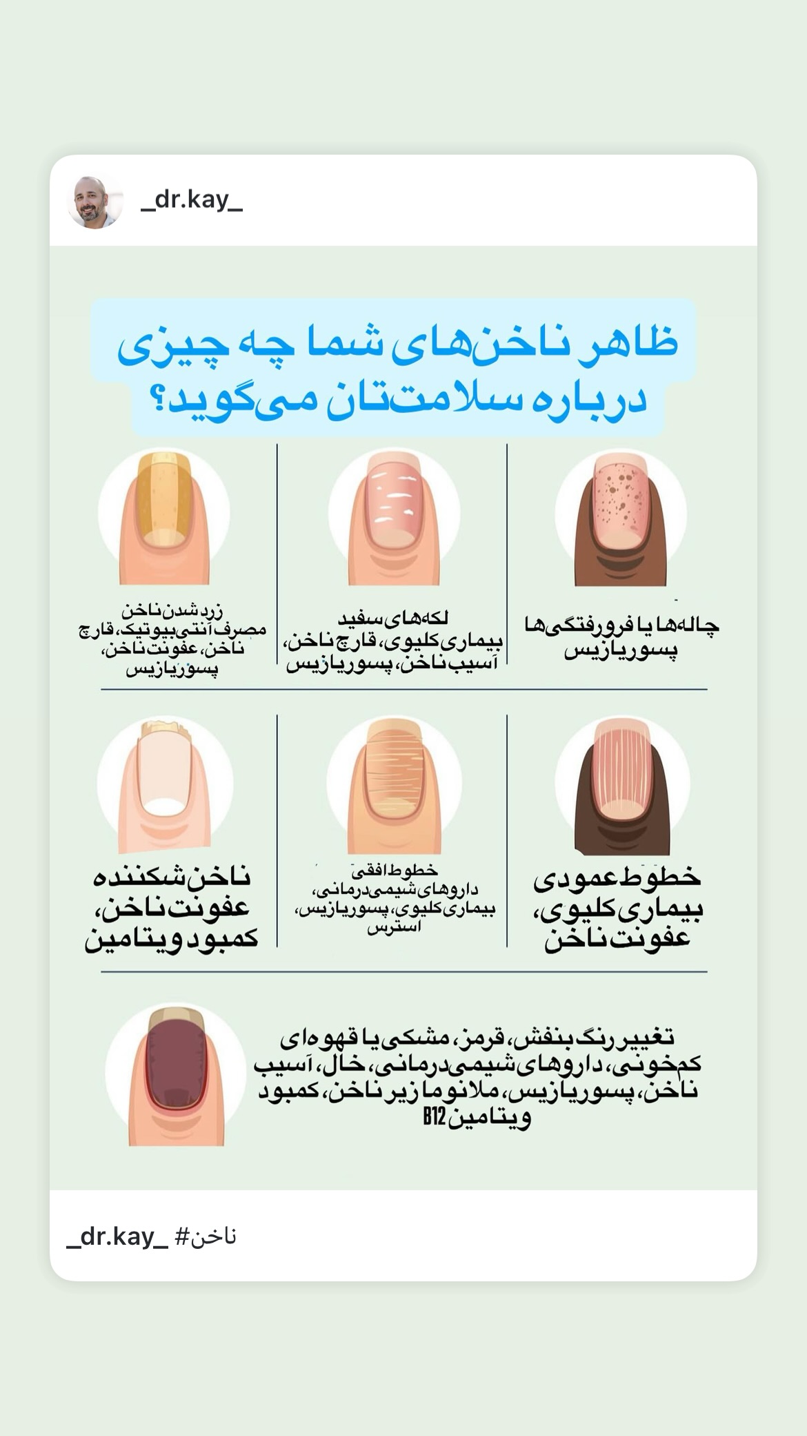  جدید ترین استوری اینستاگرام کیوان میرهادی