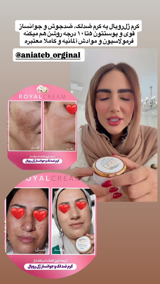  جدید ترین استوری اینستاگرام مائده عابدی